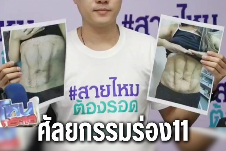 ศัลยกรรมร่อง11
